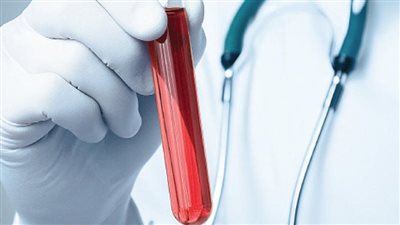 باحثون يطورون طريقة جديدة لتشخيص تسمم الدم| دراسة