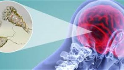 تحذيرات من انتشار الأميبا آكلة الدماغ المنتشرة في بريطانيا