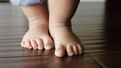 علامات تنذر بخطر إصابة الأطفال بالكساح