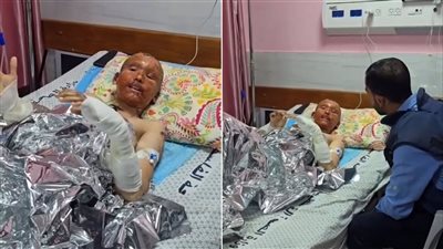 رئيس اتحاد الفنانين العرب يناشد بتبني استغاثة الطفل الفلسطيني عمر الحصري الناجي من مجزرة مستشفى الشفاء