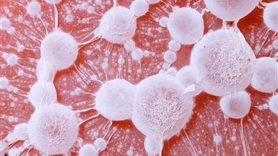 باحثون يتوصلون لطريقة جديدة للكشف عن سرطان البروستاتا يمكنها خفض الوفيات بنسبة 40%