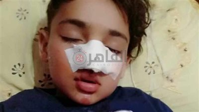 إصابة صغير سقط من أعلى سطح المنزل خلال لهوه بالفيوم