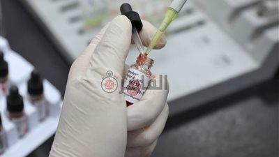 تشغيل جهاز “بلازما الدم” لعلاج مصابى كورونا فى سوهاج.. اعرف التفاصيل