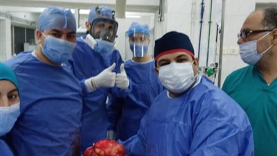 استئصال ورم يزن 20 كيلوجرامًا من سيدة بمركز أورام طنطا