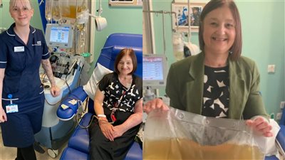 بعدما حصلت على يدين بديلتين.. سيدة أمريكية تخضع لعلاج جديد يمنع الجسم من رفض الأعضاء المزروعة