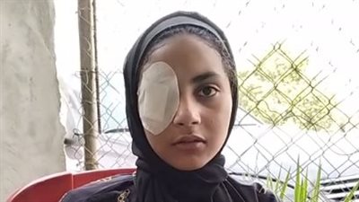 إصابة طالبة في مشاجرة داخل مدرسة ببني سويف: حدفوني بطوبة في عيني ومبقتش أشوف بيها| بث مباشر