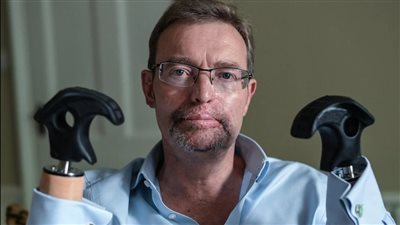 بترت أطرافه.. نائب برلماني بريطاني يروي تفاصيل إصابته بمرض خطير 