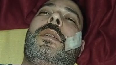 بعد تعدي 8 أشخاص عليه.. صاحب محل بالغربية يستغيث: قطعوا كف إيدي عشان قولتلهم سيبوني آكل عيش| بث مباشر