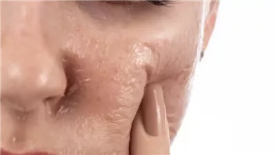 كيفية حماية البشرة من أضرار الهواء الملوث؟