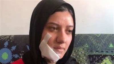 سيدة تعتدي على صاحبة أتيليه ببورسيعد.. والضحية تستغيث: دمرت شغلي وحياتي وأخدت 15 غرزة في وشي | بث مباشر 