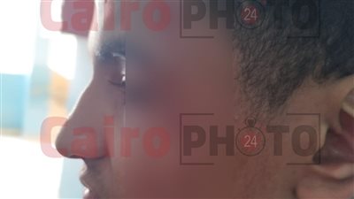 طلاب يعتدون على زميلهم بـ كتر لسرقة هاتفه داخل مدرسة إعدادية بالهرم