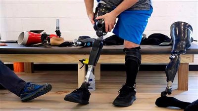 القوات المسلحة تنظم مراسم تسليم الأطراف التعويضية لضحايا الألغام