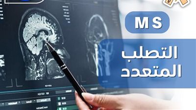 صحة كفر الشيخ: مرض التصلب المتعدد من أمراض المناعة الذاتية ويؤثر على الجهاز العصبي