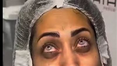 بعد انتشارها.. تحذيرات من عمليات تغيير لون قرنية العين