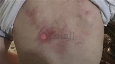 لم تصن أمانة المهنة.. استغاثة سيدة بعد تعدي أخصائية تخاطب على نجلها بالضرب| بث مباشر