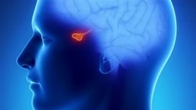 خبراء يكشفون أسباب الاختلالات الهرمونية الناتجة عن أورام الغدة النخامية 