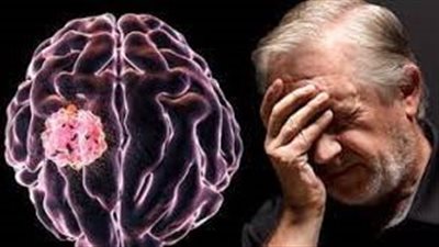 نقص فيتامين ب قد يسبب الإصابة بمرض باركنسون | دراسة