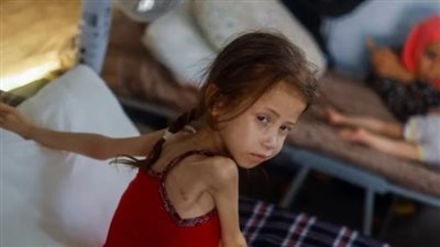 استقبال 21 طفلا فلسطينيّا من مرضى السرطان للعلاج بالمستشفيات المصرية 