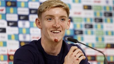 لاعب منتخب إنجلترا بعد سقوطه من الدراجة: حاولت التقاط صورة لعائلتي