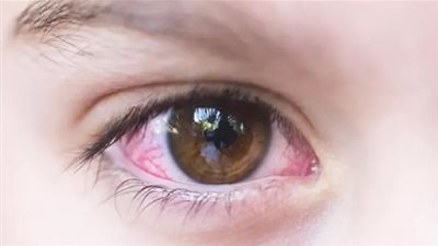 أبرزها زيوت الأسماك.. فيتامينات تزيد من تعزيز صحة العيون 