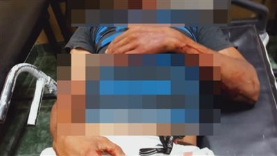 هاجم أمي بكلابه وكان هيموتني.. شاب يحرر محضرا ضد مسجل خطر تعدى عليه بأسلحة بيضاء في المرج