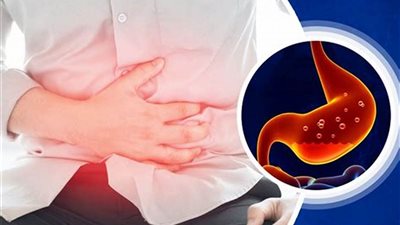 الانتفاخ والغثيان أبرزها.. تعرف على أعراض الإصابة بـ الطفيليات المعوية؟