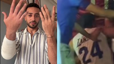 حاولت أجري منهم معرفتش وقعدو يضربوا فيا.. أقوال البلوجر بيسو المعتدى عليه في عيد ميلاد مريم الحركي