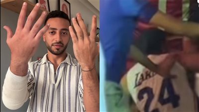 البلوجر حسن بيسو يعلق على إصابته في عيد ميلاد مريم الحركي: هجيب حقي بالقانون| خاص