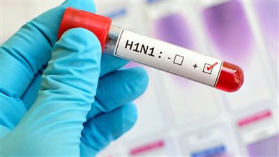 بعد رصدها في إسبانيا.. إنفلونزا الخنازير تهدد العالم وتنتقل عبر الطعام 