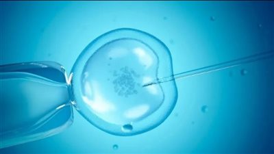 كيف يساعد تجميد البويضات النساء في تنظيم الأسرة؟