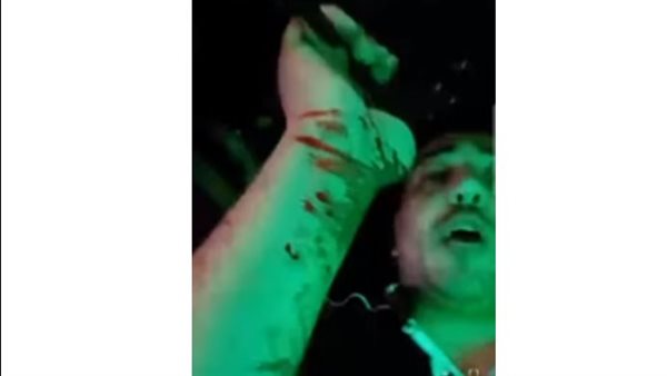 جانب من الفيديو 