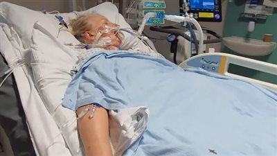 بيكربونات الصوديوم تنقذ سيدة من مرض خطير بعد تدهور حالتها الصحية