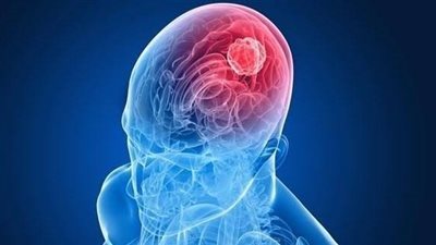 هل يمكن للأدوات الإلكترونية التسبب في أورام المخ؟.. دراسة توضح