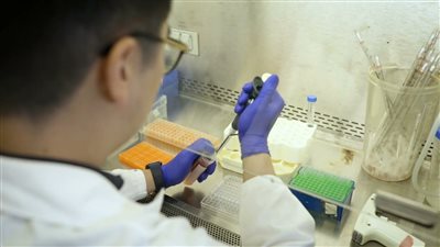 علماء يحددون سبب مرض الذئبة وسبل علاجه