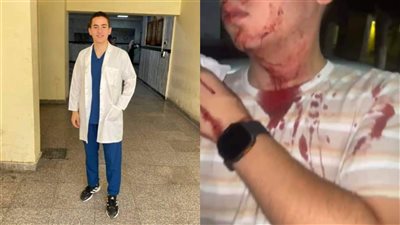 شقيقة الدكتور سمير عثمان المهدد بالقتل على يد نجل عمه بدمياط: تسبب في عاهة مستديمة لأخويا وهددنا بالمولوتوف