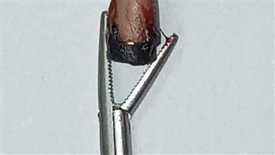 الغش للجميع شعار المرحلة.. طبيب بأسيوط خلال منشور: حضر للعيادة 6 طلاب ثانوية عامة خلال يوم لاستخراج سماعة بلوتوث 