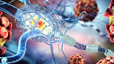 عقار جديد يظهر نتائج واعدة في علاج التصلب المتعدد