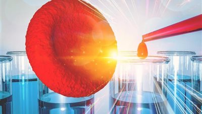 دراسة: اختبار البروتين في الدم يساعد على التنبؤ بالعديد من الأمراض