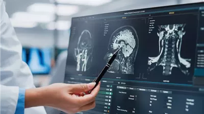 دراسة: مادة فعالة بالأدوية قد تسهم في تقليل خطر الإصابة بالخرف 