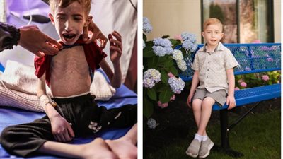 بين التليف الكيسي والجفاف.. الطفل الفلسطيني فادي الزنط يتصدر وسائل الإعلام العالمية 