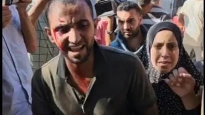 ابني أبيض وشعره قصير.. فلسطيني يحمل جثمان طفله دون رأس