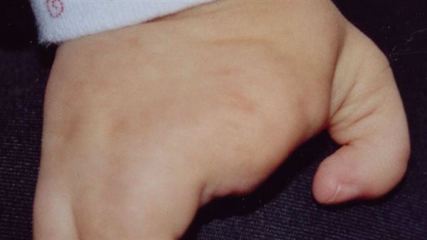 مرض الشبح في كوريا