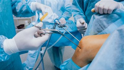 ألم وتورم مزمن.. متى تصبح جراحة استبدال الركبة ضرورية؟