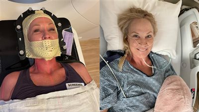 تعاني من صداع نصفي منذ عام.. اختبار كوفيد ينقذ مريضة بسرطان الجلد من الموت 