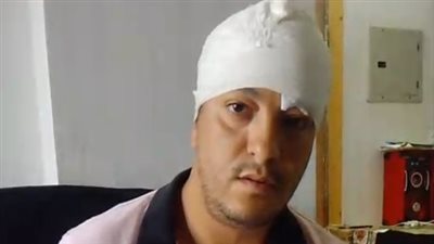 بسبب مستحقات متأخرة.. مُحصّل يستغيث من أصحاب عقار ببولاق: عمل لي عاهة مستديمة وكسرلي الجمجمة| بث مباشر 