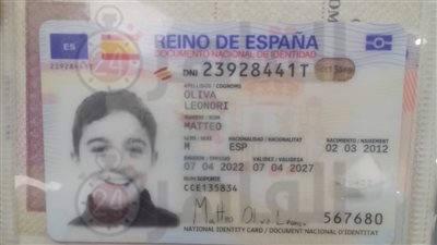 تفاصيل جديدة في واقعة عقر كلب ضال لـ صغير إسباني الجنسية أثناء زيارته معبد إدفو بأسوان 