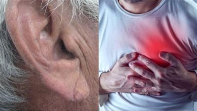 من علامات أمراض القلب.. حالة طبية تؤثر في مظهر شحمة الأذن وتشير للسكتة الدماغية