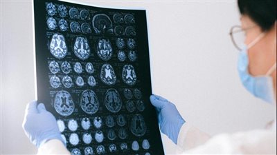 دراسة: معالجة عوامل الخطر المسببة للخرف تقلل الإصابة بنسبة 45%