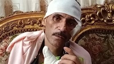 قهوجي تعدى عليه 20 شخصًا بالضرب لدفاعه عن سيدة بدمياط: ضربوني في مكان أكل عيشي| بث مباشر