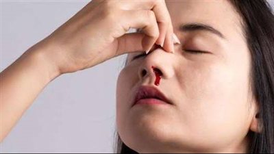 علامة شائعة بالأنف تشير لحالات مرضية خطيرة.. تعرف عليها